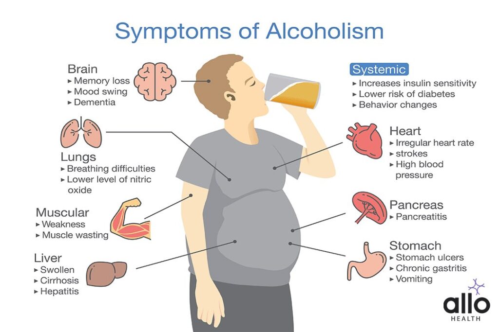 Alcohol Addiction And Sexual Dysfunction 2 Symptom of alcoholism patient. Illustration about health problem of people with alcohol addiction.
