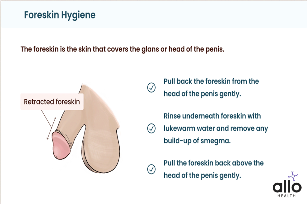 What Is A Foreskin? 1 Foreskin Care & Hygiene