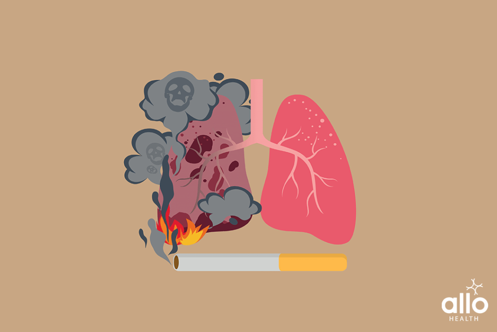 Major Organs Negatively Affected Due To Nicotine Addiction