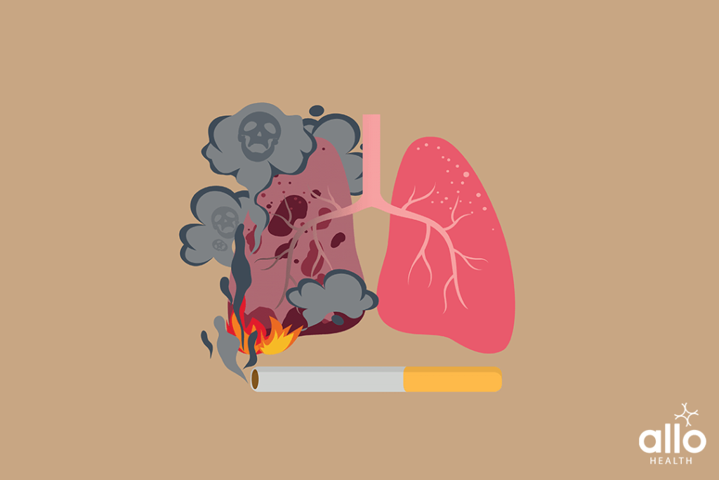 Nicotine Addiction And Sexual Dysfunction 3 Major Organs Negatively Affected Due To Nicotine Addiction