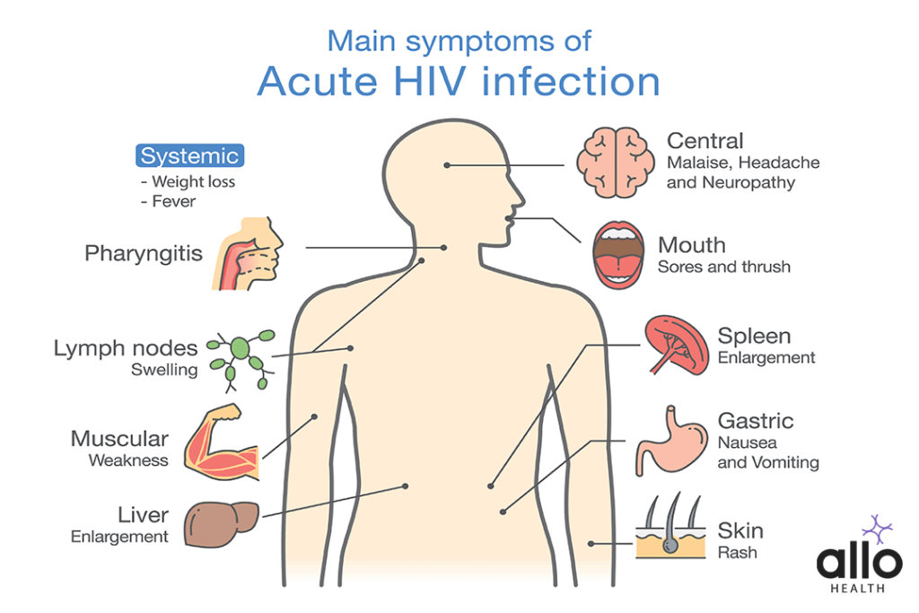 Symptoms of HIV