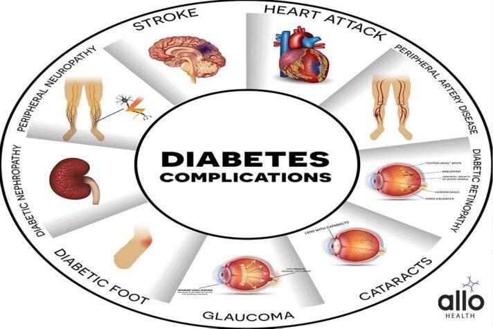 Exploring The Relationship Between Diabetes and Sex 2 Char showing all the Complications with Diabetes