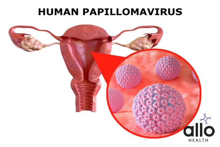 HPV cervical cancer What is Human Papillomavirus (HPV)? Vaginal Warts And Odour