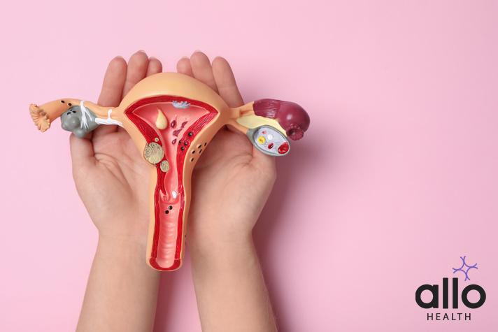 bulky uterus in hindi, stage 4 endometriosis life expectancy