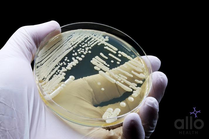 Yogurt For Vaginal Yeast Infections: Is It Safe? What is Candidiasis (Yeast Infection)?