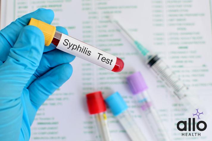 Can Ginger Cure Syphilis? Understanding The Pathogenesis Of Syphilis Syphilis Understanding Dementia From Syphilis

Treating Ocular Syphilis: Understanding the Treatment Options
